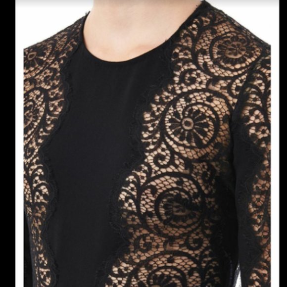 STELLA MCCARTNEY Lace Knee-Length Dress, Size: S - Picture 5 of 7